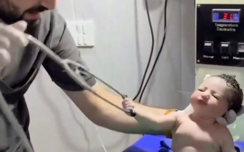 Bebê surpreende ao segurar estetoscópio de médico logo após nascer