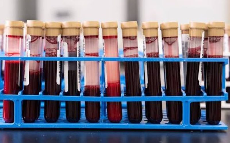 Exame de sangue que rastreia sinais de mais de 50 tipos de câncer chega ao Brasil